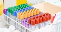 PNRR, APPROVATI E FINANZIATI QUATTRO PROGETTI DI RICERCA BIOMEDICA